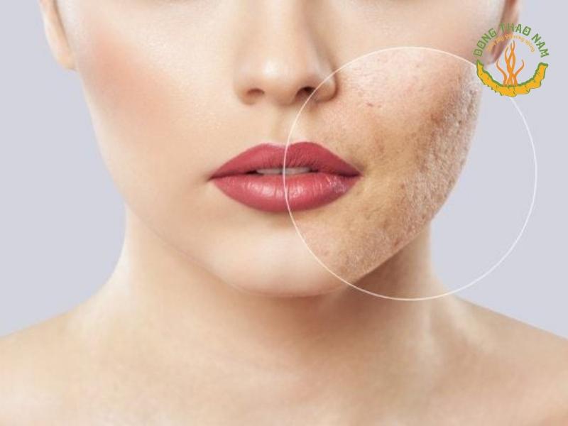 phục hồi da xỉn màu với Glutabright Skin